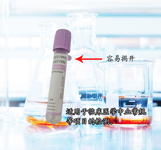 盛世东唐EDTAK3血常规全血管3ML